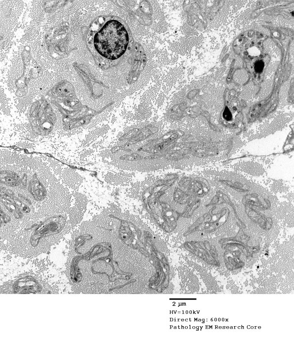 1C1 PseudoOB (Case 1)_082A - Copy