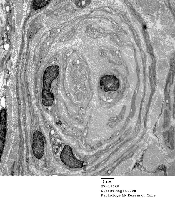 1C12A PseudoOB (Case 1)_028A - Copy