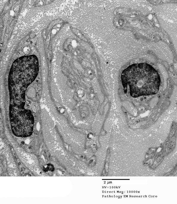 1C12B PseudoOB (Case 1)_030A - Copy