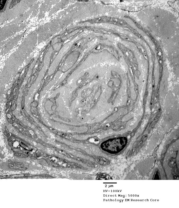 1C13A PseudoOB (Case 1)_067A - Copy