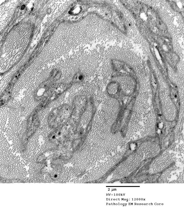 1C13B PseudoOB (Case 1)_068A - Copy