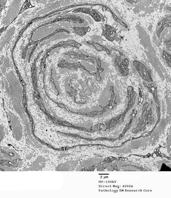 1C14A APseudoOB (Case 1)_075A - Copy