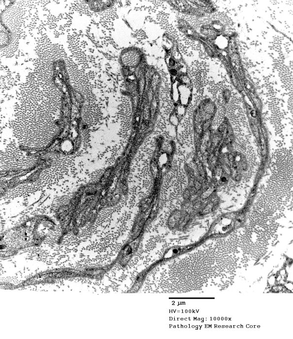 1C14B PseudoOB (Case 1)_076A - Copy