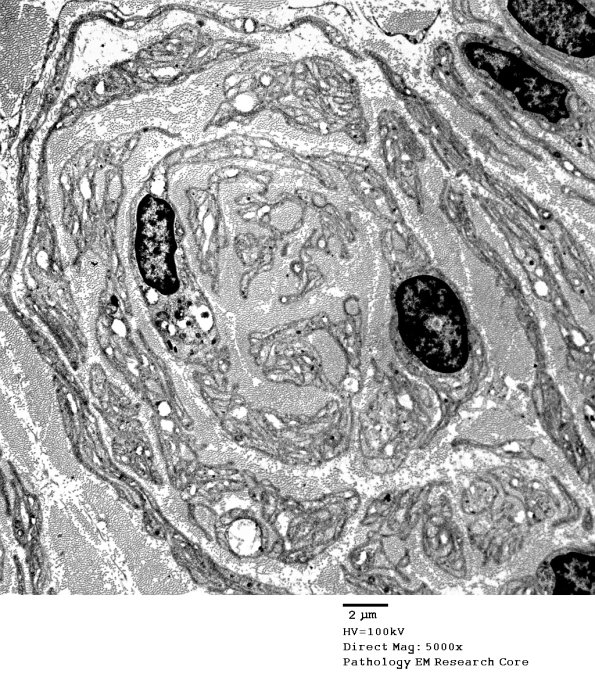 1C15A PseudoOB (Case 1)_078A - Copy