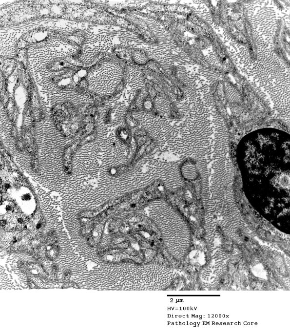 1C15B PseudoOB (Case 1)_079A - Copy