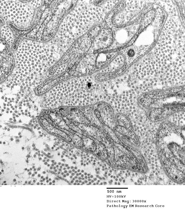 1C2 PseudoOB (Case 1)_084A - Copy