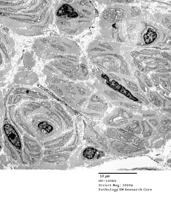 1C3 PseudoOB (Case 1)_092AA - Copy