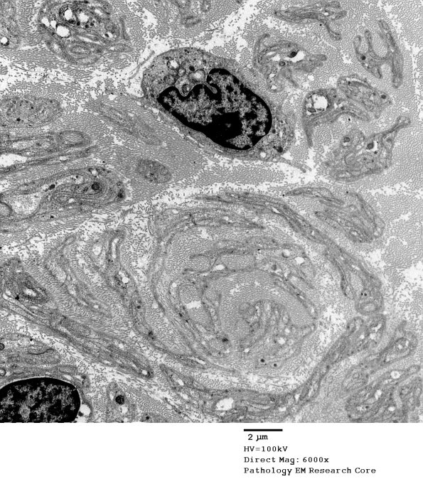 1C4 PseudoOB (Case 1)_089A - Copy