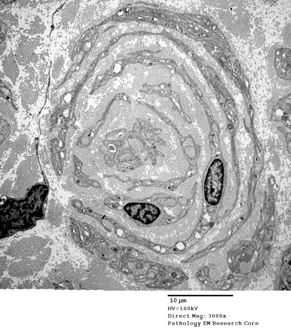 1C7 PseudoOB (Case 1)_093A - Copy