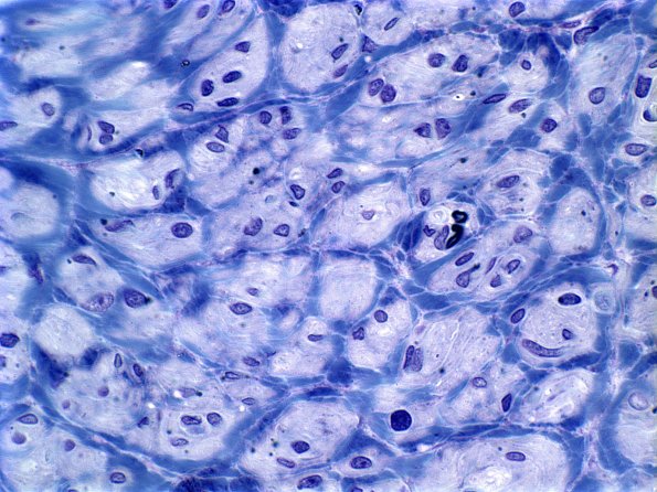 2E3B (Case 2) Plastic 3