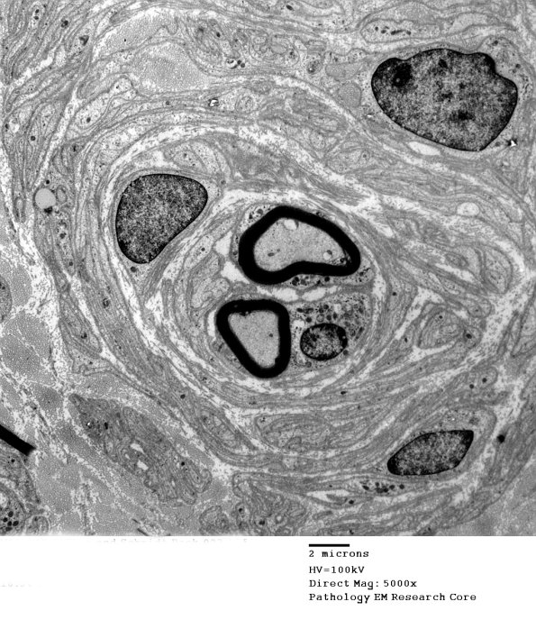 2F10 (Case 2) EM023 - Copy