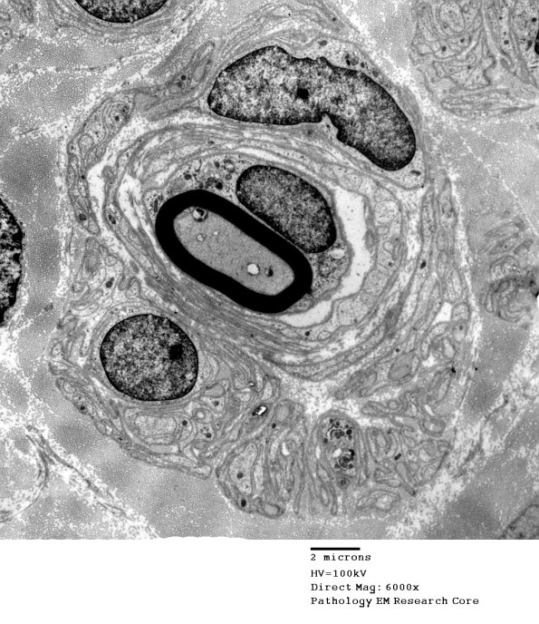 2F3A PseudoOB (Case 2) EM 028A - Copy