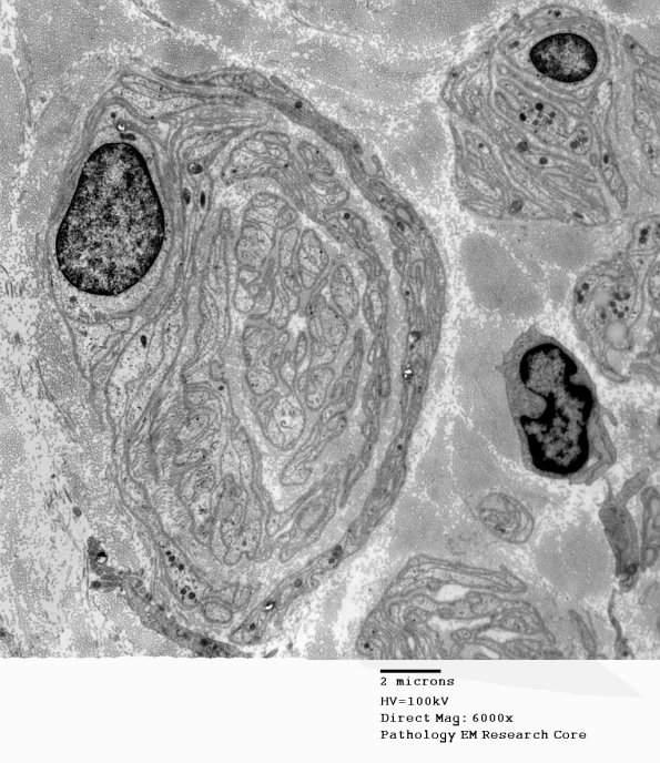 2F4 PseudoOB (Case 2) EM 035A - Copy