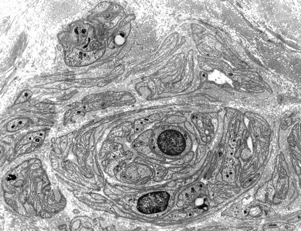2F5A PseudoOB (Case 2) EM 1 - Copy