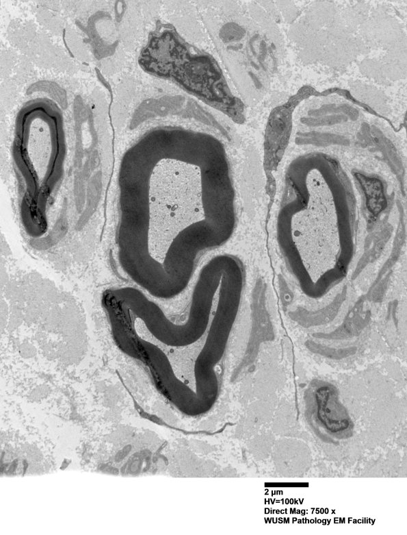 6C1 (Case 6) EM051 - Copy