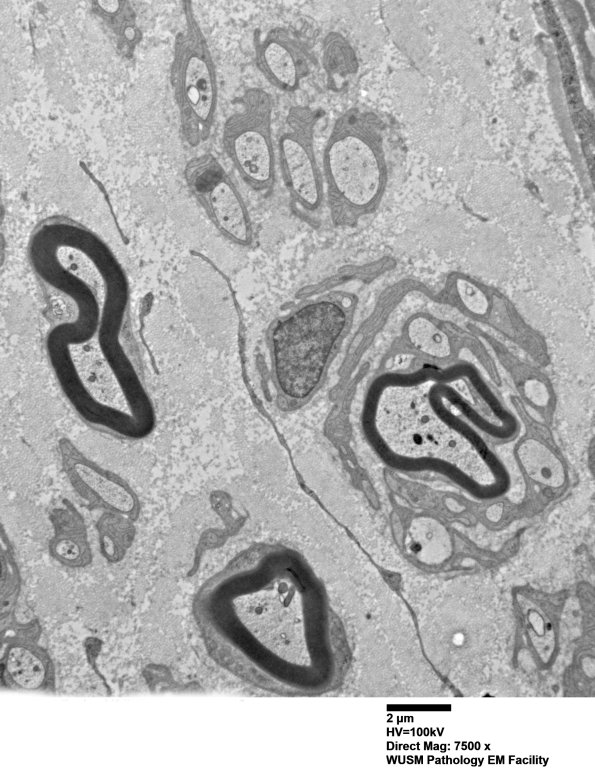 6C3 (Case 6) EM016 - Copy