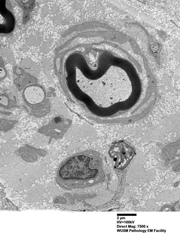 6C4 (Case 6) EM038 - Copy