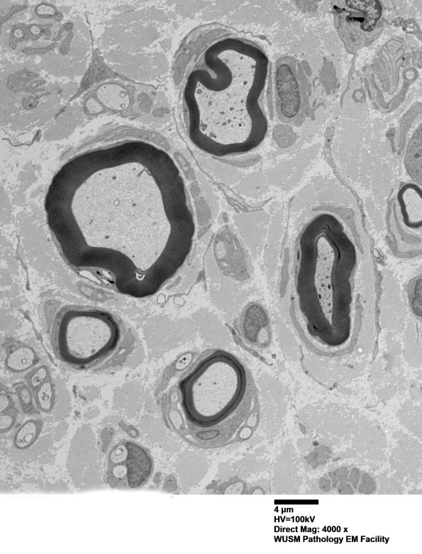 6C7 (Case 6) EM002 - Copy