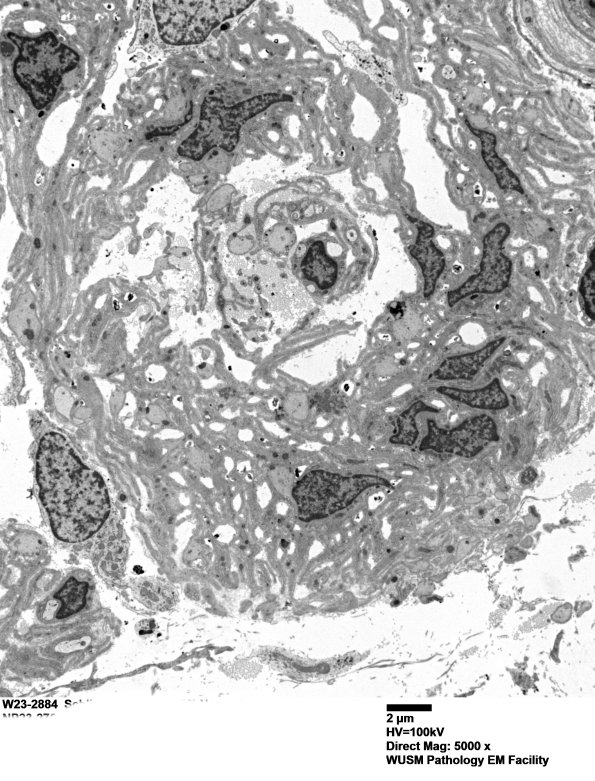 8C2A (Case 8) Nerve_016 - Copy