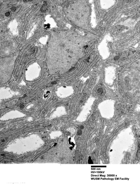 8C2B (Case 8) Nerve_004 - Copy