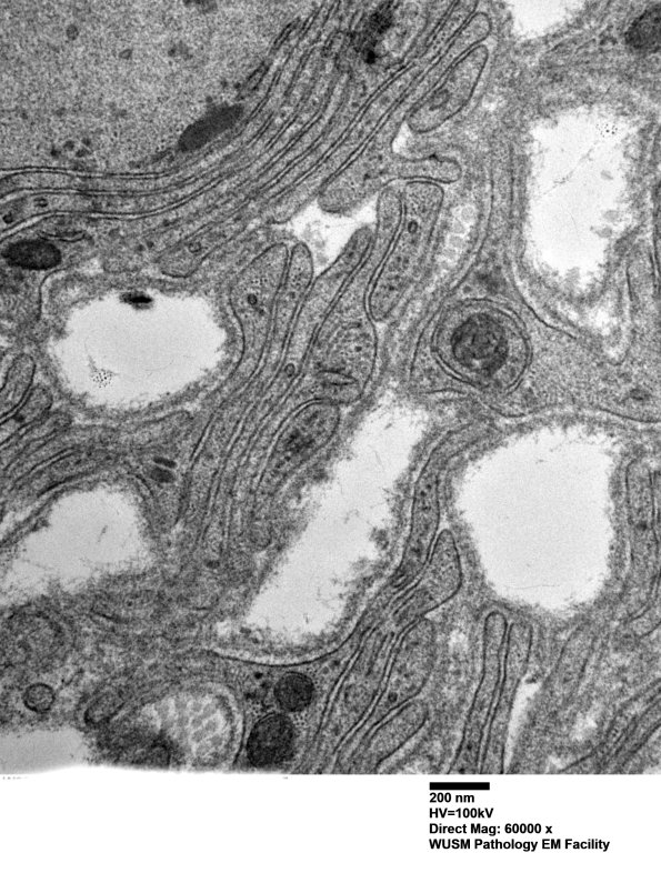 8C2C (Case 8) Nerve_005 - Copy