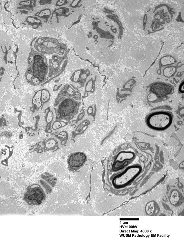 9B2 (Case 9) SURAL_006 - Copy
