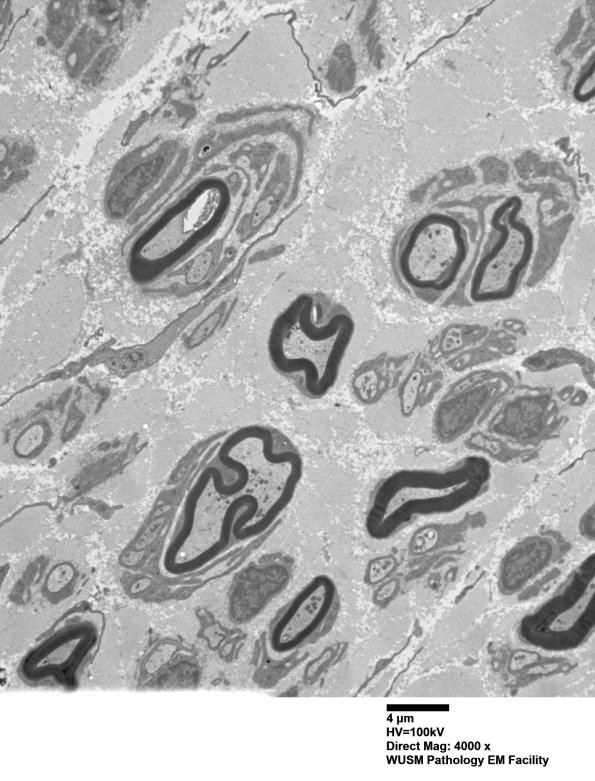 9B3 (Case 9) SURAL_007 - Copy