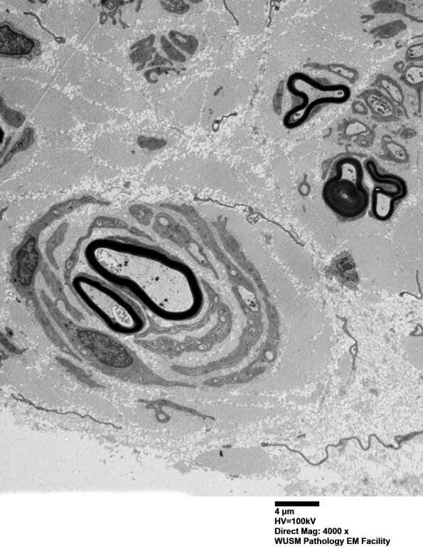 9B4 (Case 9) SURAL_001 - Copy