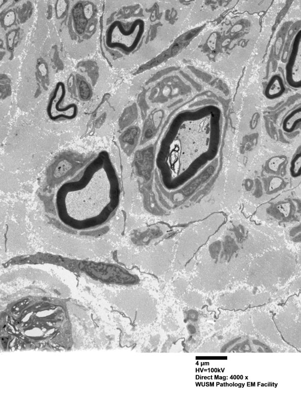 9B5 (Case 9) SURAL_008 - Copy