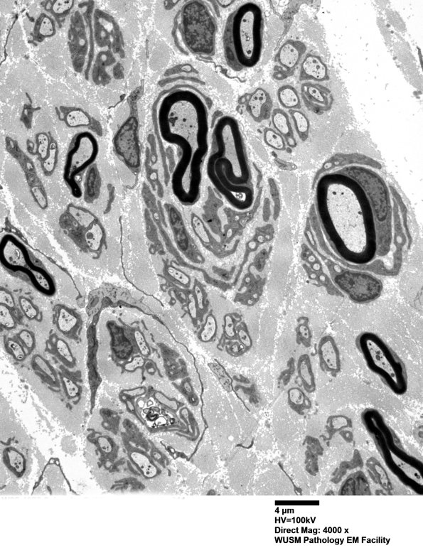 9B6 (Case 9) SURAL_011 - Copy