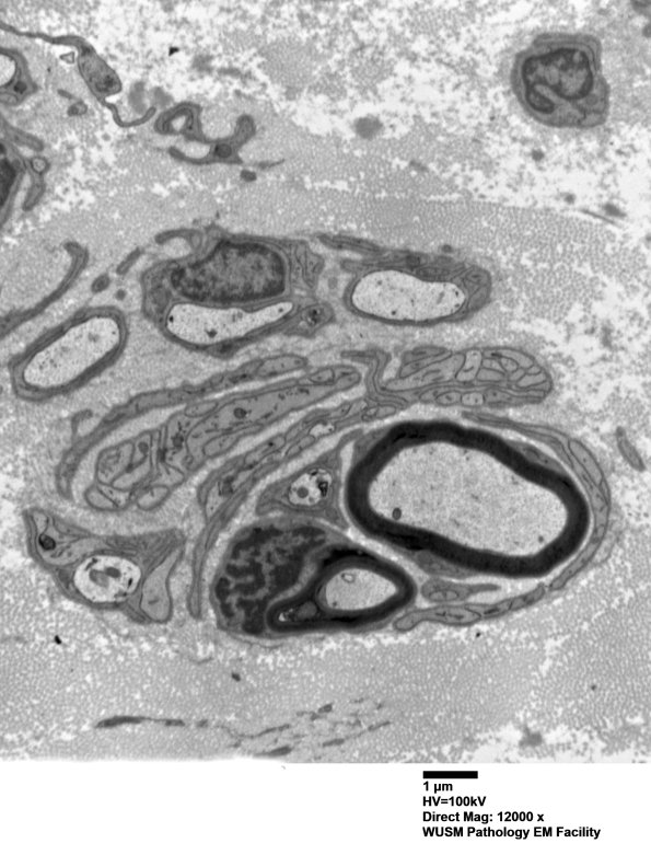 9B7 (Case 9) SURAL_012 - Copy