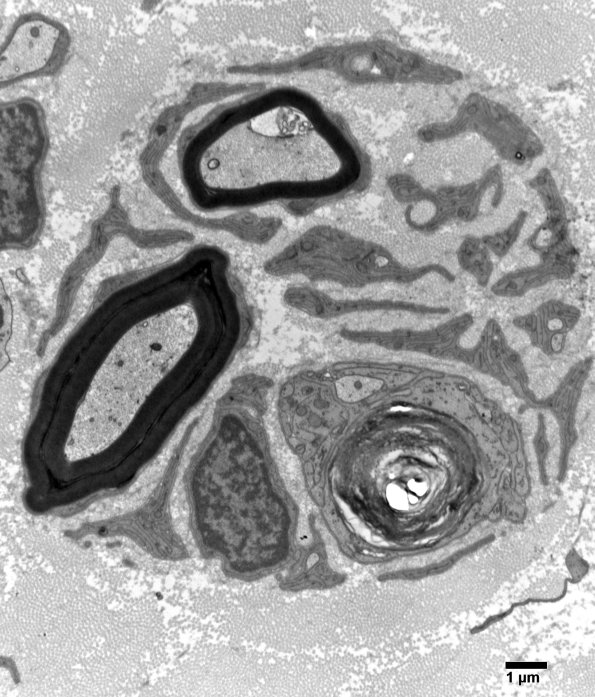 9B8 (Case 9) SURAL_018 - Copy