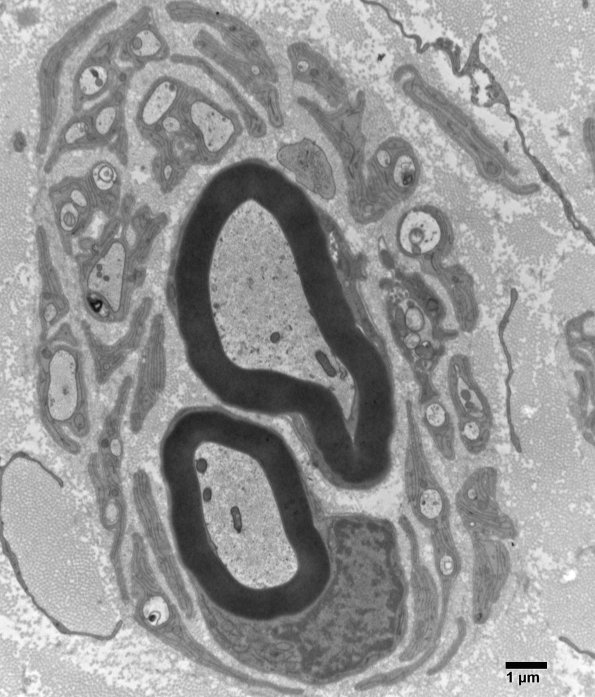 9B9 (Case 9) SURAL_020 - Copy