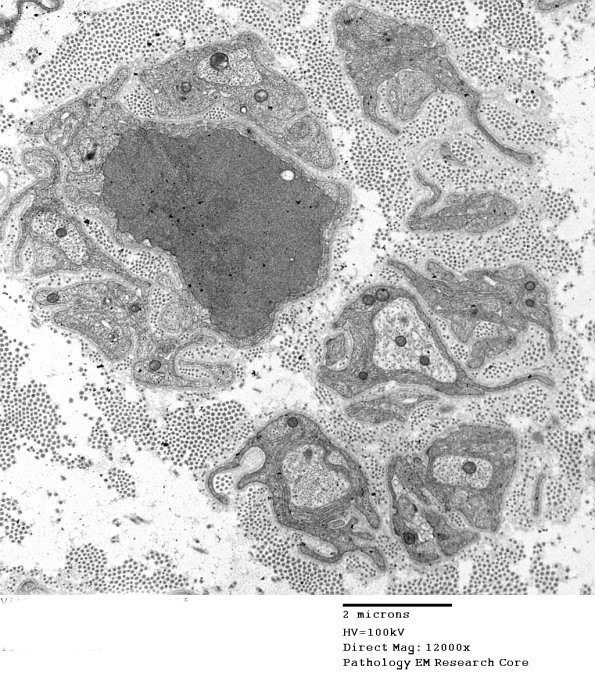 1B3A VitE Def (Case 1)_030 - Copy