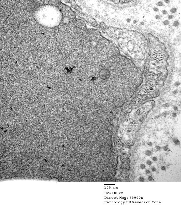 1B3B VitE Def (Case 1)_032 - Copy