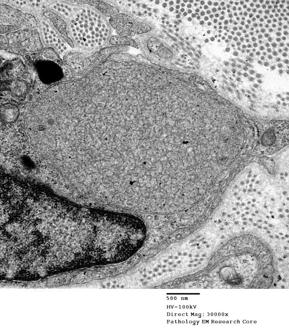 1B4A VitE Def (Case 1)_039 - Copy