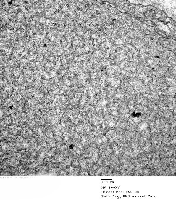 1B4B VitE Def (Case 1)_036 - Copy