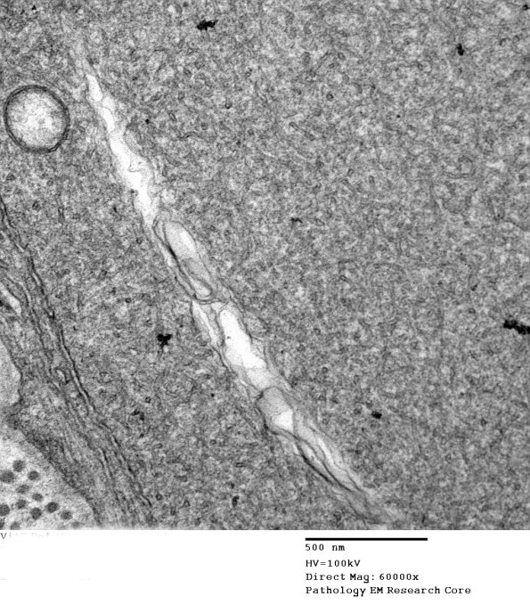 1B5B VitE Def (Case 1)_008 - Copy