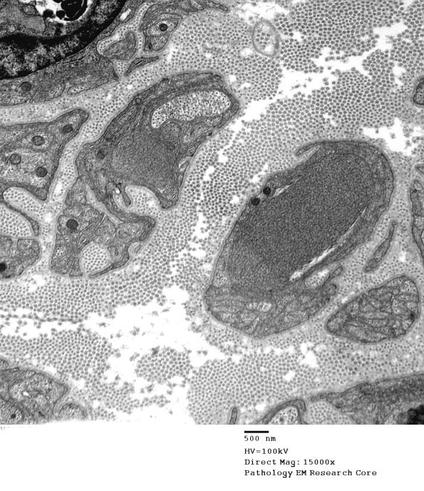 1B6A Vit E Deficiency (Case 1)_016 - Copy