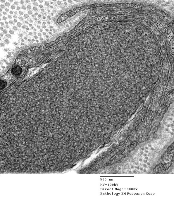 1B6B Vit E Deficiency (Case 1)_017 - Copy