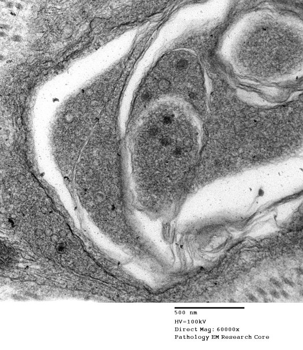 1B7C VitE Def (Case 1)_004 - Copy