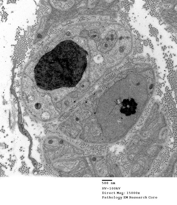 1B8A VitE Def (Case 1)_010 - Copy