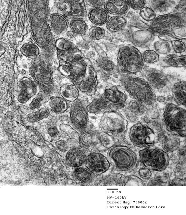 1B9C Vit E Deficiency (Case 1_013 - Copy
