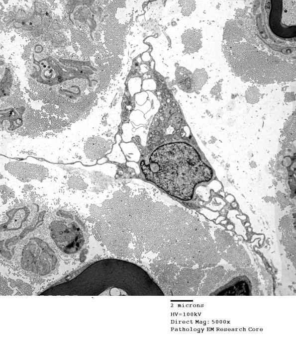 1C3 VitE Def (Case 1)_051 - Copy