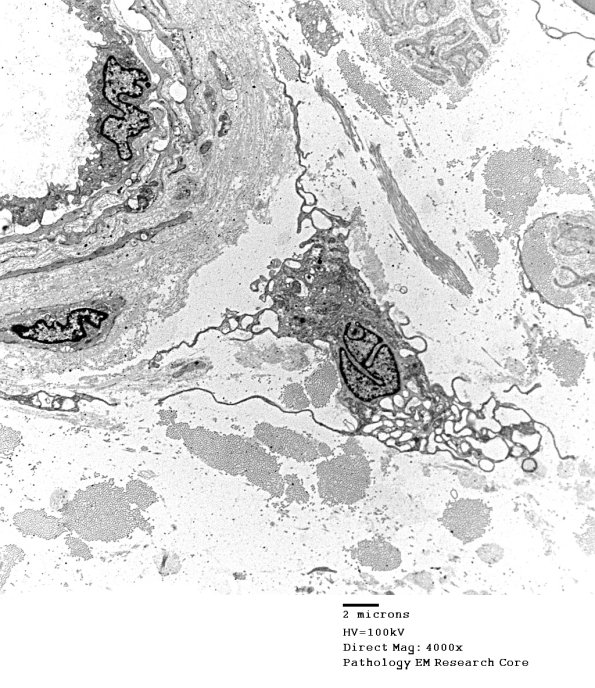1C4A VitE Def (Case 1)_021 - Copy