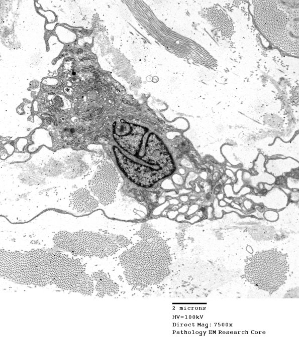 1C4B VitE Def (Case 1)_024 - Copy