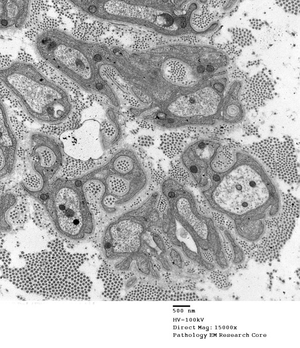 1D VitE Def (Case 1)_014 - Copy