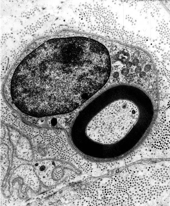 1A1 1EM 18 - Copy - Copy