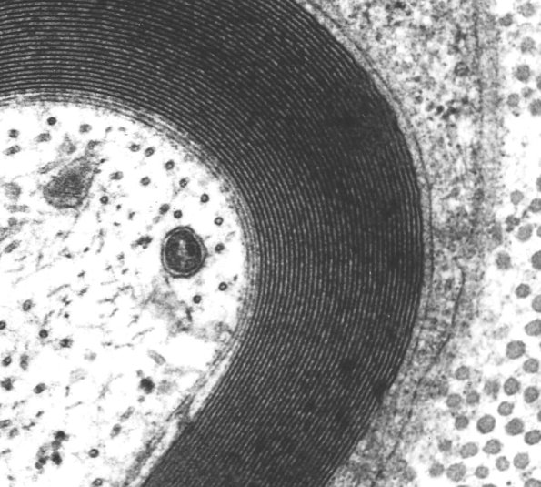 1A2 Axon, normal, PNS EM 3 (2) - Copy - Copy