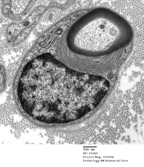 4A POEMS (Case  4) - Copy